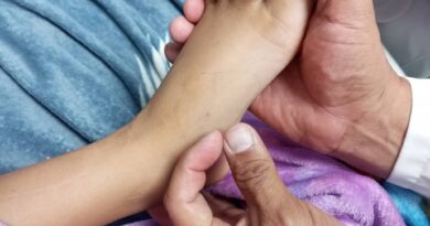 Otro caso de mordedura por serpiente coral en paciente pediátrico es salvado en el Iahula